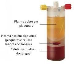 Plasma rico em plaquetas e fibrina