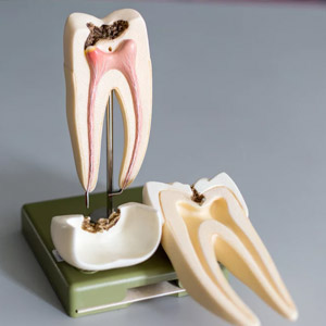 https://ikenoodonto.com.br/wp-content/uploads/2021/06/endodontia.jpg